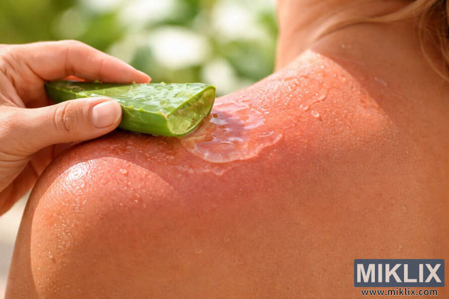 Imagem em close-up de uma mão aplicando gel fresco de aloe vera, extraÃdo de uma folha cortada, sobre a pele rosada e queimada de sol do ombro, sob luz natural. Imagem em close-up de uma mão aplicando gel fresco de aloe vera, extraÃdo de uma folha cortada, sobre a pele rosada e queimada de sol do ombro, sob luz natural.