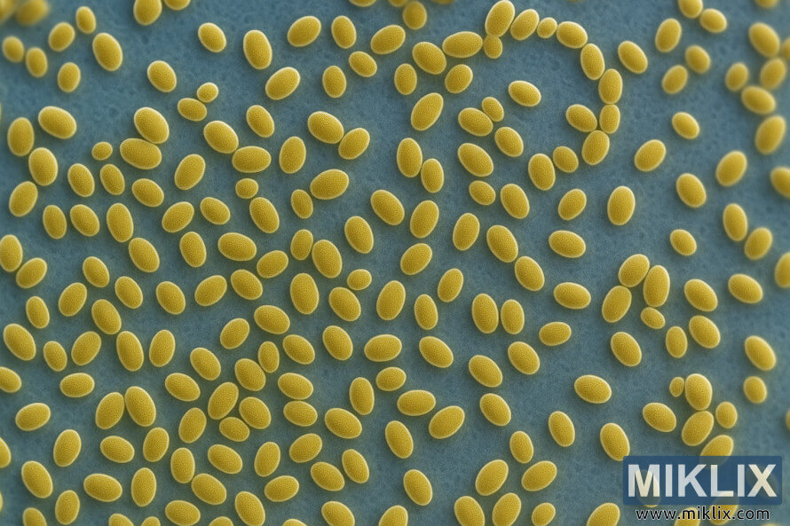 à¤¸à¥à¤à¤°à¥à¤®à¤¾à¤à¤¸à¤¿à¤¸ à¤¸à¥à¤°à¥à¤µà¤¿à¤¸à¥ var. à¤¡à¤¾à¤¯à¤¸à¥à¤à¥à¤à¤¿à¤à¤¸ à¤¯à¥à¤¸à¥à¤ à¤¸à¥à¤²à¥à¤¸ à¤à¥ à¤¹à¤¾à¤-à¤°à¤¿à¤à¤¼à¥à¤²à¥à¤¯à¥à¤¶à¤¨ à¤®à¤¾à¤à¤à¥à¤°à¥à¤¸à¥à¤à¥à¤ªà¤¿à¤ à¤à¤®à¥à¤, à¤à¤¿à¤¸à¤®à¥à¤ à¤¨à¥à¤²à¥ à¤¬à¥à¤à¤à¥à¤°à¤¾à¤à¤à¤¡ à¤ªà¤° à¤¸à¥à¤¨à¤¹à¤°à¥ à¤à¤à¤¡à¥ à¤à¥à¤¸à¥ à¤¸à¥à¤à¥à¤°à¤à¥à¤à¤° à¤¦à¤¿à¤ à¤°à¤¹à¥ à¤¹à¥à¤à¥¤