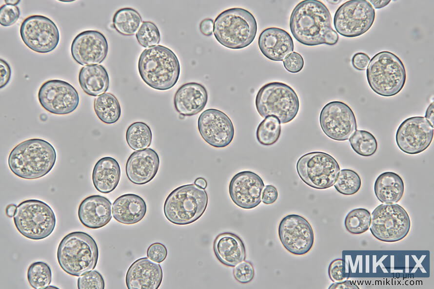Microscope view of round and oval yeast-like cells, many with small attached buds, on a pale gray background with a 10 Âµm scale bar.