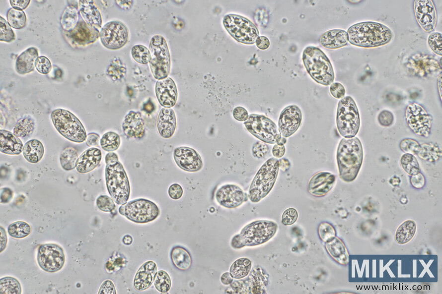 Microscopic view of numerous oval and elongated yeast-like cells, including budding pairs and clusters, against a pale gray field. Microscopic view of numerous oval and elongated yeast-like cells, including budding pairs and clusters, against a pale gray field.