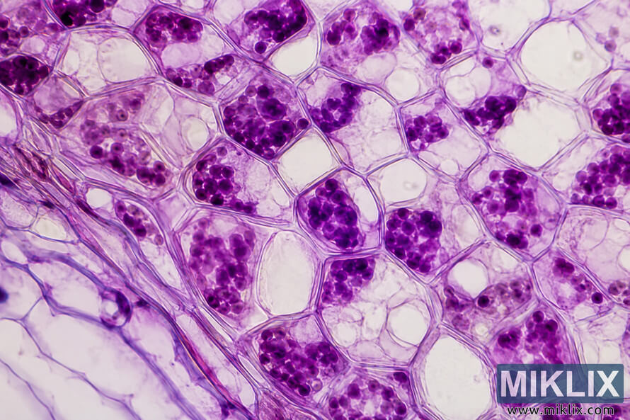 High-magnification microscopic view of purple radicchio plant cells showing polygonal cell walls, pale vacuoles, and dense purple pigment-rich granules representing antioxidant compounds against a light background. High-magnification microscopic view of purple radicchio plant cells showing polygonal cell walls, pale vacuoles, and dense purple pigment-rich granules representing antioxidant compounds against a light background.