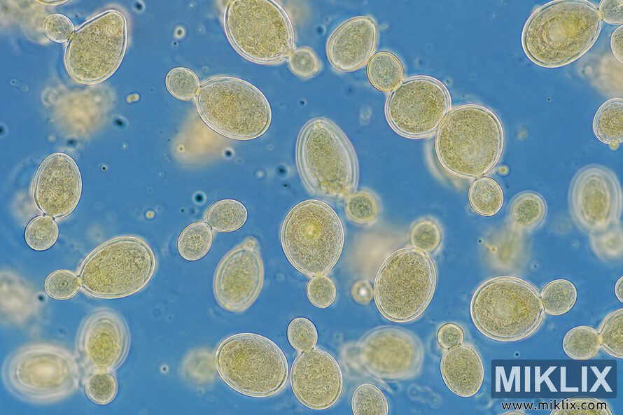 Detailed microscopic view of Kölsch yeast cells suspended in a vibrant blue aquatic environment, showing oval cell structures, translucent membranes, and active budding reproduction.
