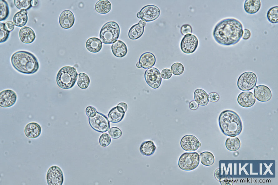 Microscope-style view of translucent round and oval yeast-like cells, including budding pairs and clusters, against a pale blue-gray background.
