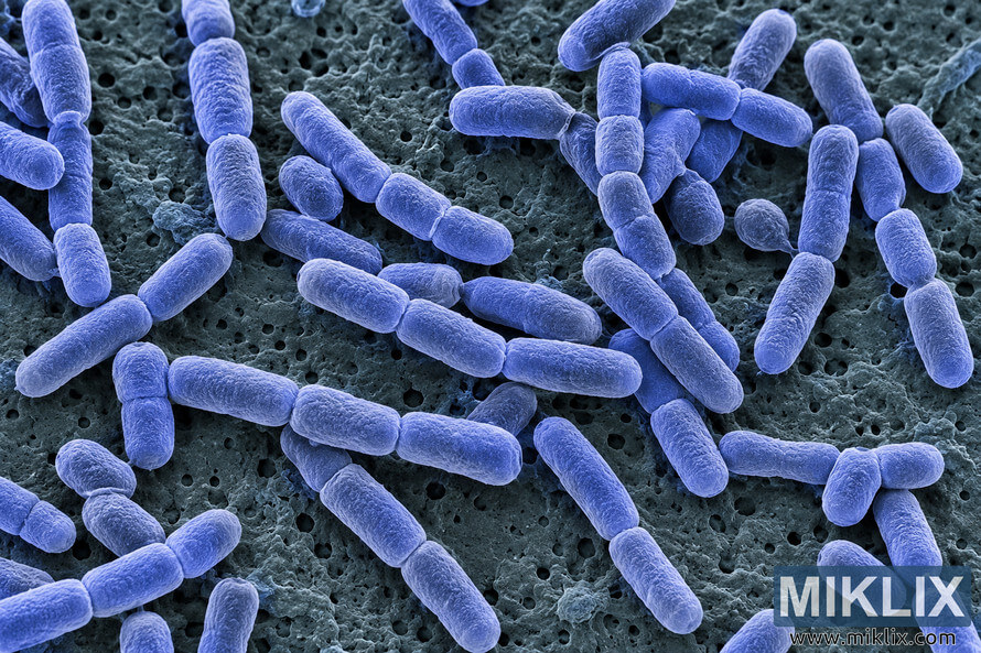 Colorized microscopic view of blue-violet rod-shaped bacterial cells scattered and clustered across a dark, porous textured surface. Colorized microscopic view of blue-violet rod-shaped bacterial cells scattered and clustered across a dark, porous textured surface.